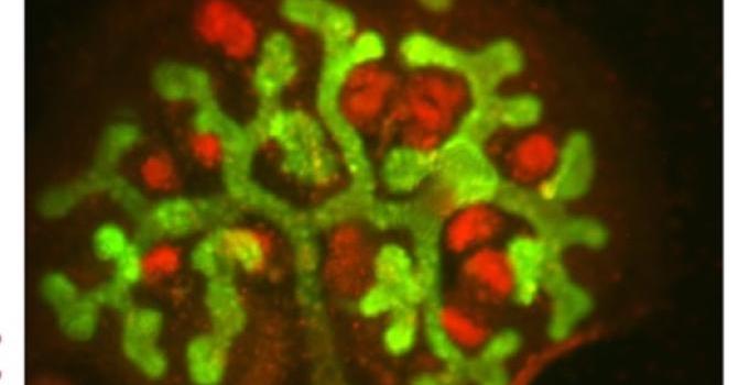 Embryonic mouse kidney explant immunostained for branching ureteric structures with pan-cytokeratin (green) and developing glomeruli with Jagged1 (red)